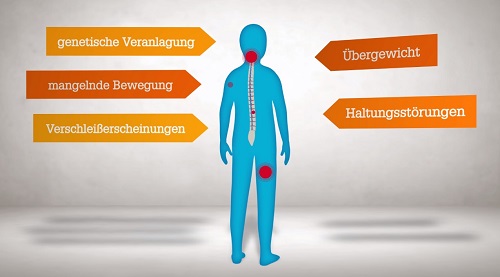 Wie Entstehen Rückenschmerzen?