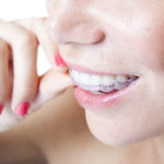 Perfekte Zähne sind “in”: <br>Markt für Zahnkorrekturen boomt